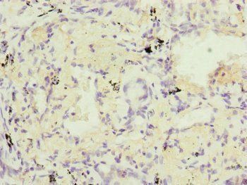 RARS2 Antibody