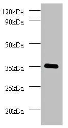 Ras-related GTP-binding protein A antibody