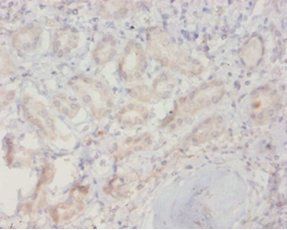 RAB10 Antibody