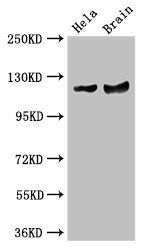 RASA1 Antibody