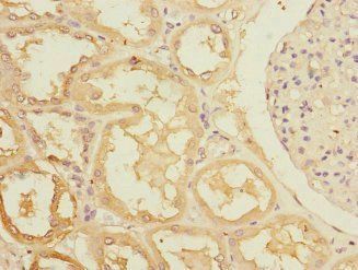 RASA4 Antibody