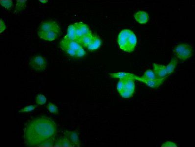 RASAL1 Antibody