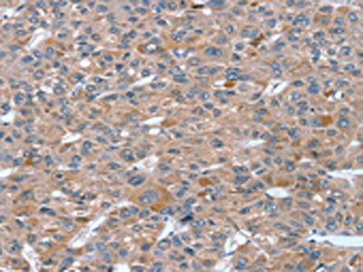 RASAL1 Antibody