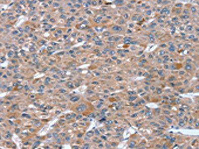 RASAL1 antibody