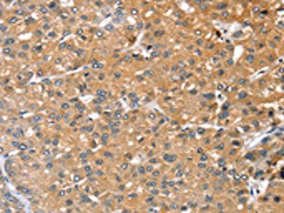 RASAL1 Antibody
