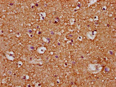 RASAL2 Antibody