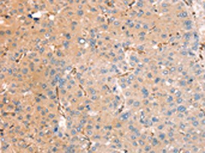 RASAL2 Antibody