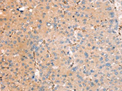 RASAL2 antibody