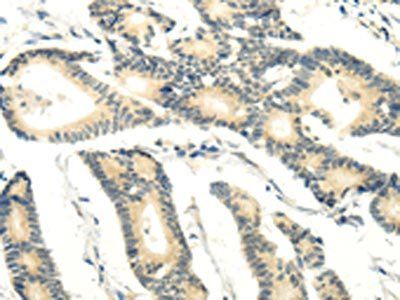 RASD2 Antibody