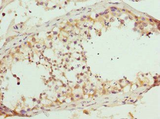RASGRF1 Antibody