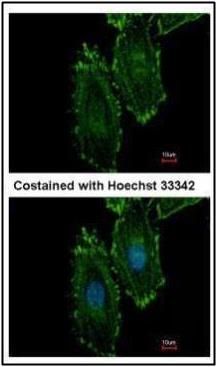 RASGRP4 antibody [N1N2], N-term