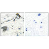 RASH/RASK/RASN Antibody