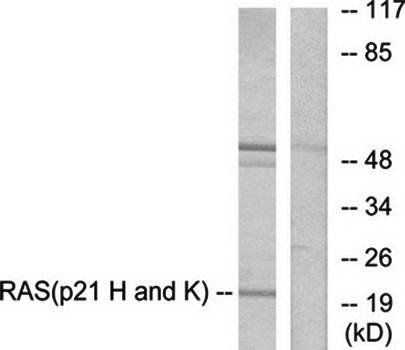 RASH/RASK/RASN Antibody