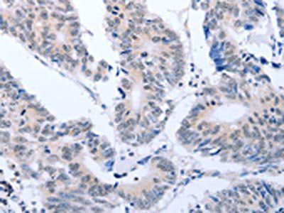 RASSF1 Antibody