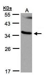 RASSF1 Rabbit Polyclonal Antibody