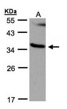 RASSF1 antibody
