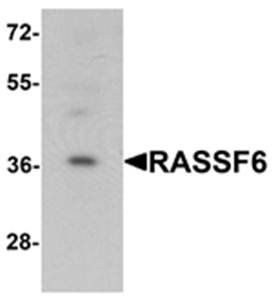 RASSF6 Antibody