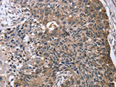 RASSF7 Antibody