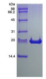 Rat FGF-21 protein