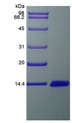 Rat MCP3 protein