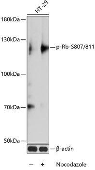 Rb (Phospho-S807/811) antibody