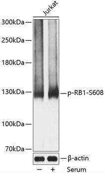 RB1 (Phospho-S608) antibody