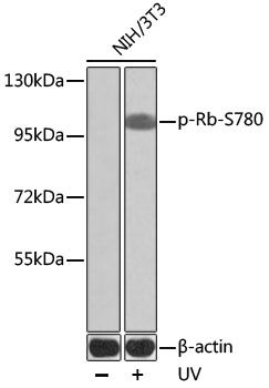 RB1 (Phospho-S780) antibody