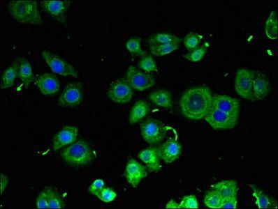 RB1CC1 Antibody