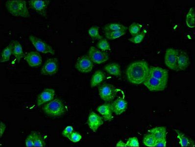 RB1CC1 antibody