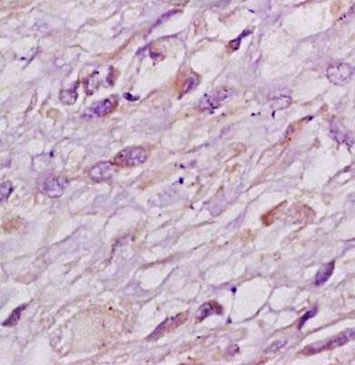 RB1CC1/FIP200 Rabbit Polyclonal Antibody
