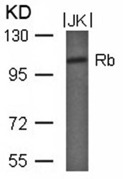 Rb (Ab-780) Antibody