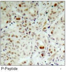 Rb (Phospho-Ser807) Antibody