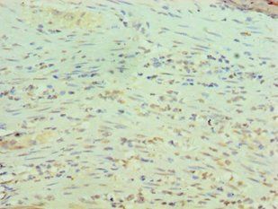 RBBP5 Antibody