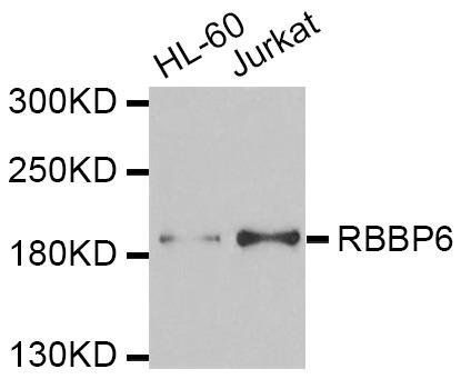 RBBP6 antibody