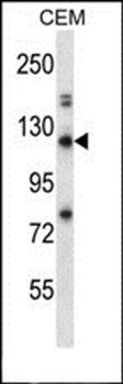 RBBP8 antibody