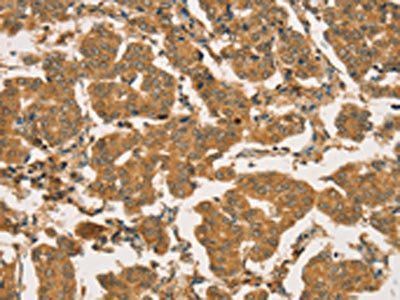 RBBP8 Antibody