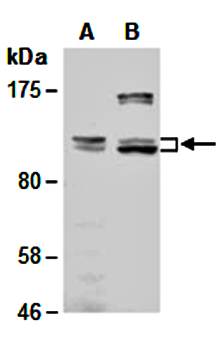 RBBP8 (N) Antibody, Rabbit Polyclonal