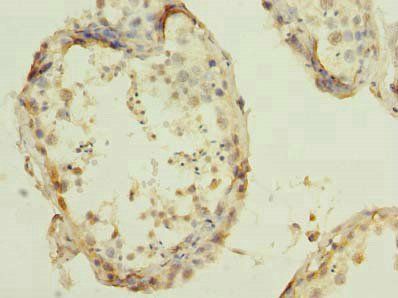 RBBP9 Antibody