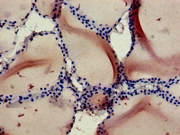 RBCK1 Antibody