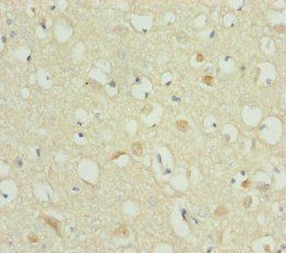RBFOX1 Antibody