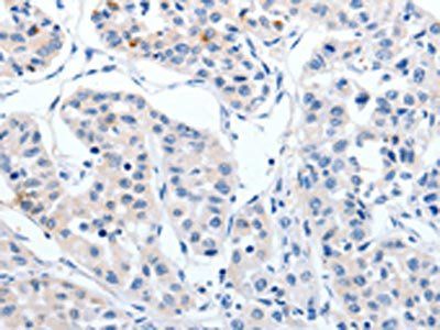 RBFOX3 Antibody