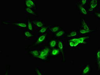 RBM10 antibody