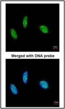 RBM15 antibody [N1N3]