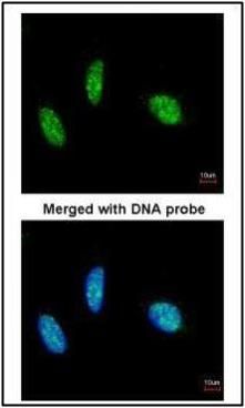 RBM15 antibody