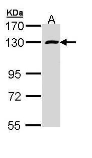 RBM15 Rabbit Polyclonal Antibody
