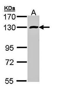 RBM15 antibody