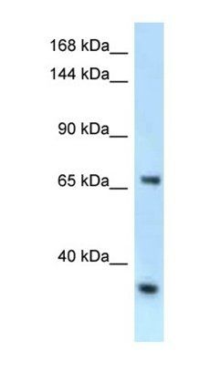 Rbm15b antibody