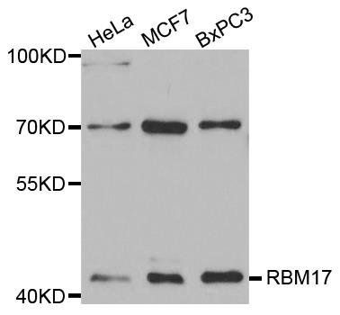 RBM17 antibody