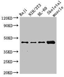 RBM22 antibody