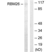 RBM26 antibody